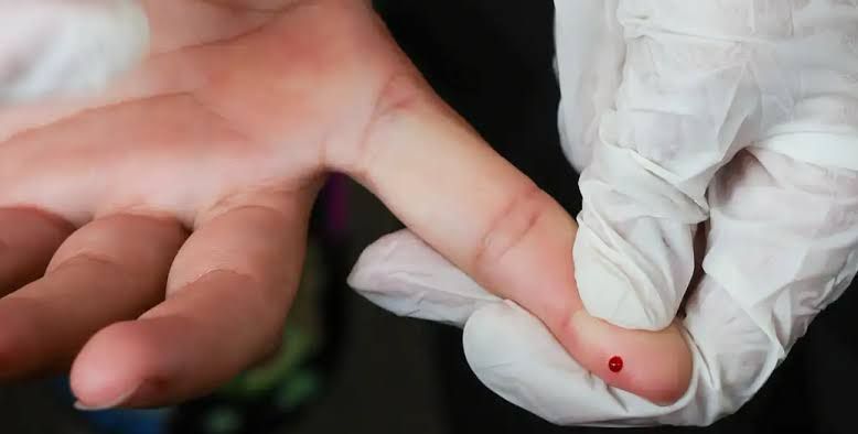 Ministério da Saúde inclui testes rápidos no SUS para ampliar diagnóstico e controle da dengue no Brasil