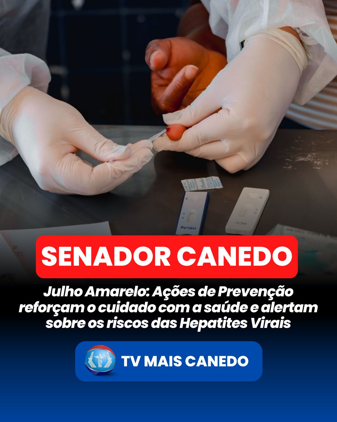 Julho Amarelo: Ações de Prevenção reforçam o cuidado com a saúde e alertam sobre os riscos das Hepatites Virais