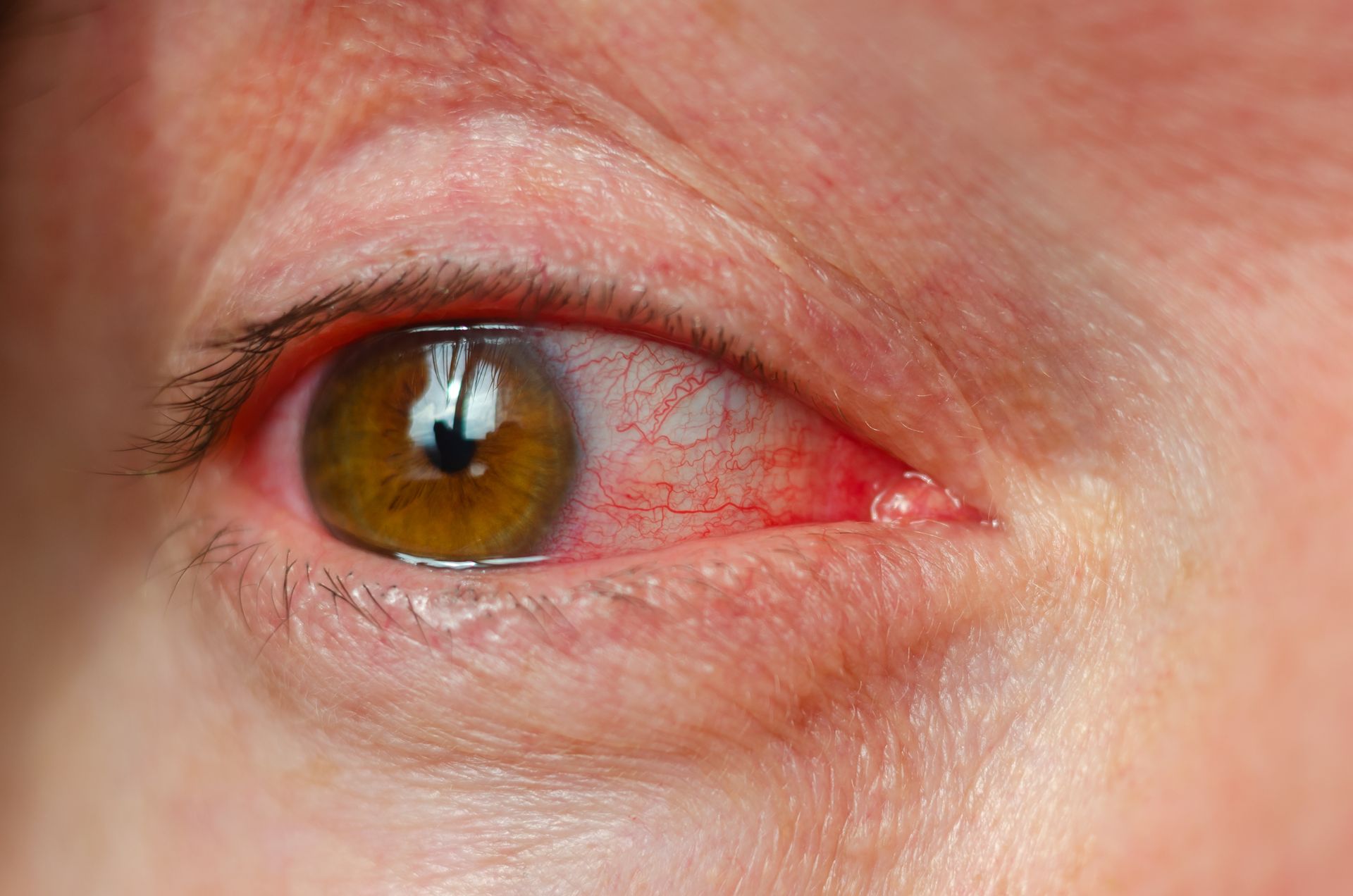 Olhos ardendo e visão embaçada? Tempo seco pode estar por trás do problema