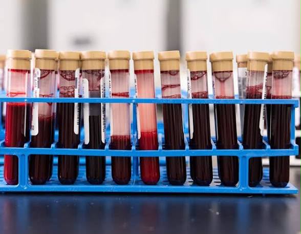 Exame de sangue que rastreia sinais de mais de 50 tipos de câncer chega ao Brasil